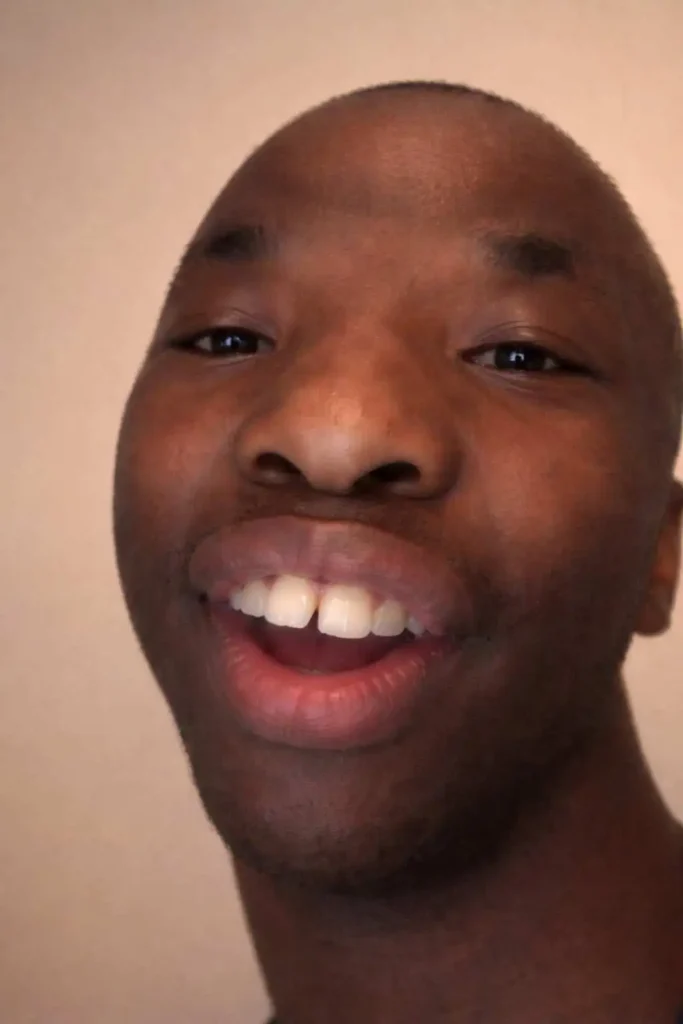 Goofy ahh meme close-up of a smiling face with exaggerated lips and teeth