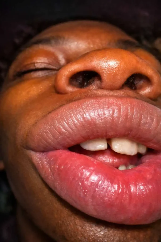 Goofy ahh meme close-up showing exaggerated lips and nose