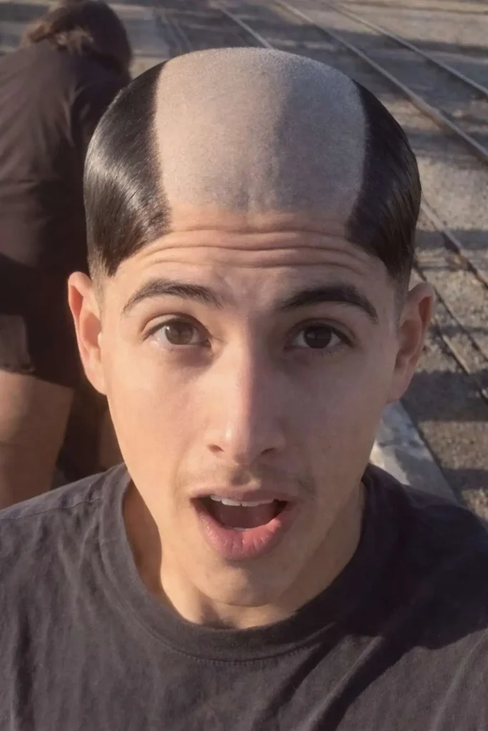 Man with a half-bald haircut featuring smooth shaved hair on top and slicked dark hair on the sides, creating a dramatic split hairstyle effect