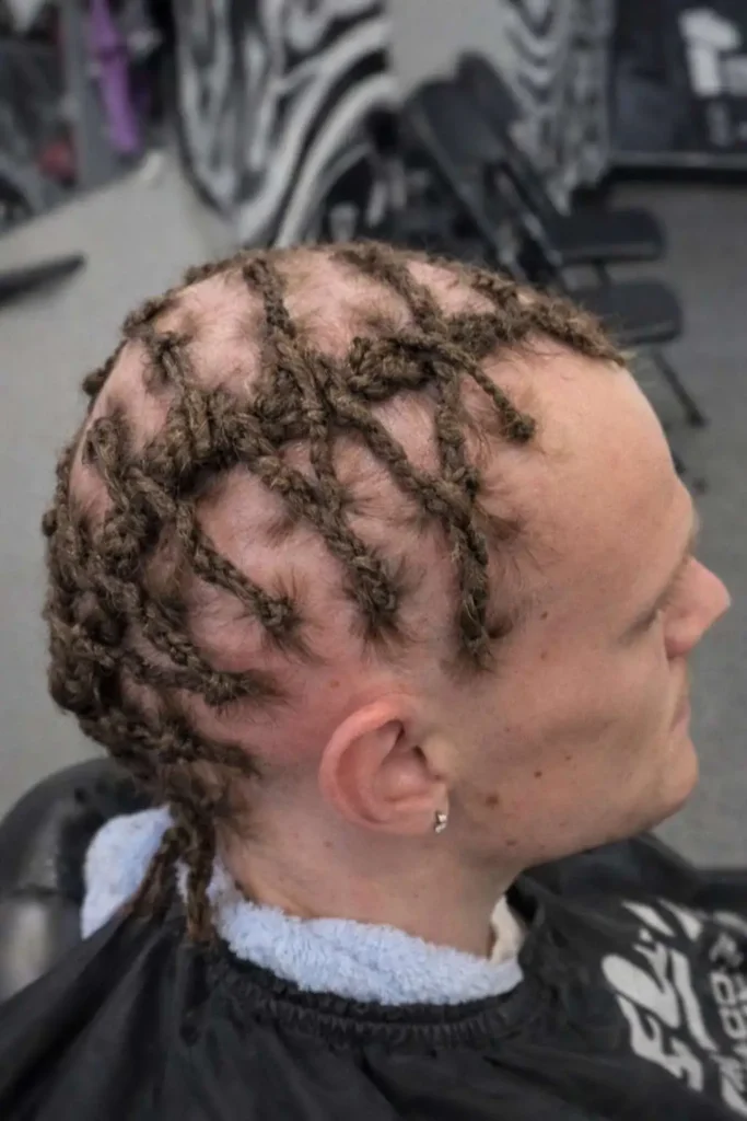 Side view of a person with tight braided cornrows styled in an uneven pattern, showing visible scalp and a distinctive braided haircut design